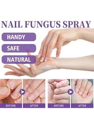 Jaysing Nail Fungus Spray