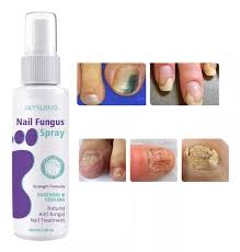 Jaysing Nail Fungus Spray
